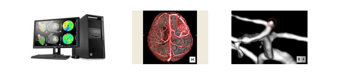 脳ドックの機器